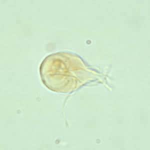 giardiasis betegseg pinworms halitosis