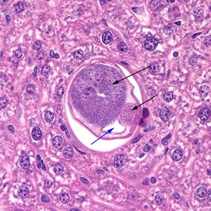 Figure A: Cross section of a male <em>C. hepatica</em> in liver tissue, stained with hematoxylin and eosin (H&E). Note the presence of the intestine (blue arrow) and the coiled sections of the testes (black arrows).