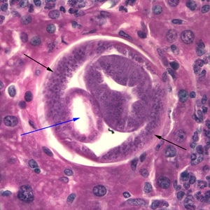 Figure B: Cross section of <em>C. hepatica</em> in liver tissue, stained with H&E. Note the presence of the intestine (blue arrow) and bacillary bands (black arrows).
