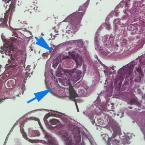 Figure C: Cross-section of <em>C. hepatica</em> in liver tissue, stained with H&E. Note the presence of a stichocyte (black arrow) and bacillary bands (blue arrows). Image taken at 200x magnification.