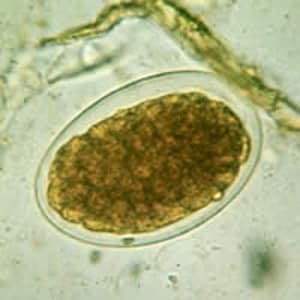 Figure E: Hookworm egg in a wet mount.
