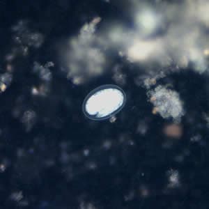 Figure F: Hookworm egg in a wet mount under UV fluorescence microscopy; image taken at 200x magnification.