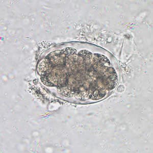 hookworm ankylostomiasis noncatorosis hogyan vizsgálják meg a tojásokat férgek szempontjából