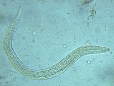 Figure A: Hookworm rhabditiform larva (wet preparation).