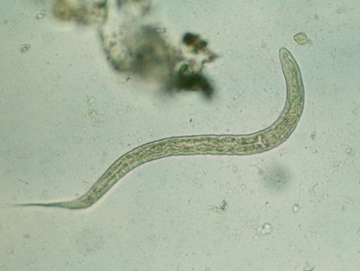 Figure B: Hookworm rhabditiform larva (wet preparation).