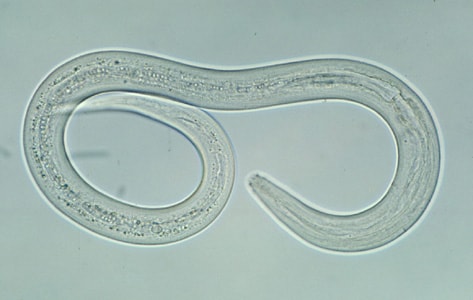 Aszcariasis hookworm fertőzés noncatorosis, A giardiasis csók révén terjed
