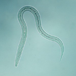 Figure B: Filariform (L3) hookworm larva.