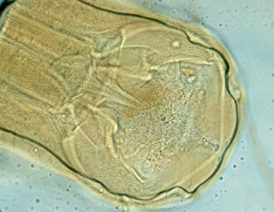 Figure B: Adult worm of <em>Necator americanus</em>. Anterior end showing mouth parts with cutting plates.