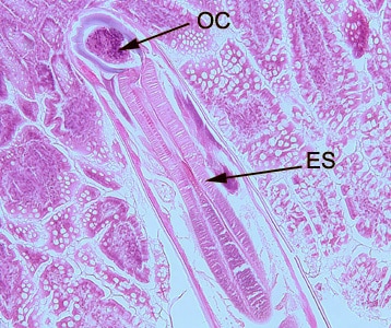 Figure A: Longitudinal section of an adult hookworm worm in a bowel biopsy, stained with H&E. Note the oral cavity (OC) and strong, muscled esophagus (ES).