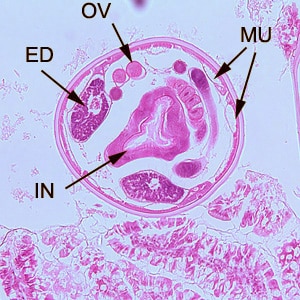 Figure B: Cross-section of an adult hookworm from the same specimen in Figure A. Shown here are the platymyarian musculature (MU), intestine with brush border (IN), excretory ducts (ED), and coiled ovaries (OV).