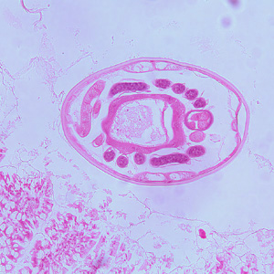 CDC - DPDx - Intestinal Hookworm