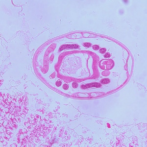 Figure C: Another-cross section of the specimen in Figures A and B.