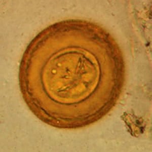 Figure A: Egg of <em>H. diminuta</em> in a wet mount stained with iodine. Four of the hooks are visible at this level of focus. Image courtesy of the Georgia Department of Public Health.