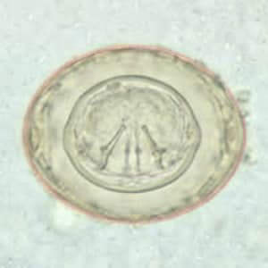 Figure B: Egg of <em>H. diminuta</em> in a wet mount stained with iodine. Four of the hooks are visible at this level of focus.