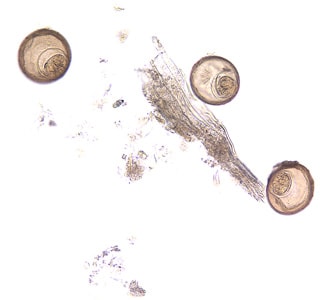 Figure C: Eggs of <em>H. diminuta</em> in an unstained wet mount of concentrated stool. Image taken at 200x magnification.