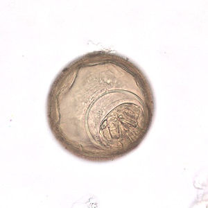 Figure D: Higher magnification (400x) of one of the eggs in Figure C.