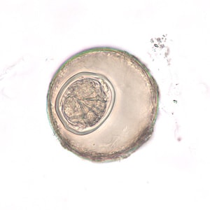 Figure E: Egg of <em>H. diminuta</em> in an unstained wet mount of concentrated stool. Image taken at 400x magnification.