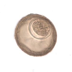 Figure F: Egg of <em>H. diminuta</em> in an unstained wet mount of concentrated stool. Image taken at 400x magnification.