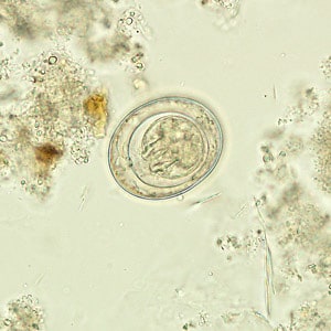hymenolepidosis epidemiológia phanerogamic paraziták