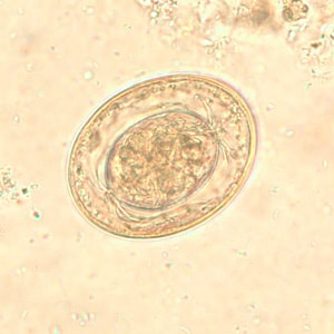 Figure F: Egg of <em>H. nana</em> in an unstained wet mount. In this image, the polar filaments in the space between the oncosphere and outer shell are clearly visible.