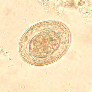 Figure F: Egg of <em>H. nana</em> in an unstained wet mount. In this image, the polar filaments in the space between the oncosphere and outer shell are clearly visible.