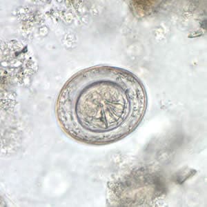 Figure A: Egg of <em>H. nana</em> in an unstained wet mount. Note the presence of hooks in the oncosphere and polar filaments within the space between the oncosphere and outer shell.