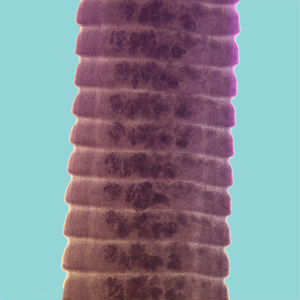 Proglattids CDC - DPDx - Hymenolepiasis