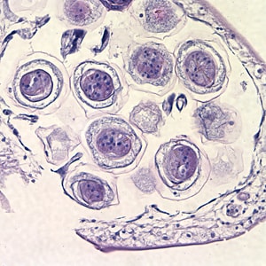 Figure B: Higher magnification of eggs within the proglottid in Figure A, taken at 400x.