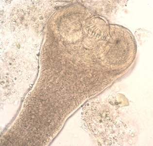 Figure C: Higher magnification of the scolex in Figure B. In this image, two of the suckers and the rostellar hooks are clearly visible.