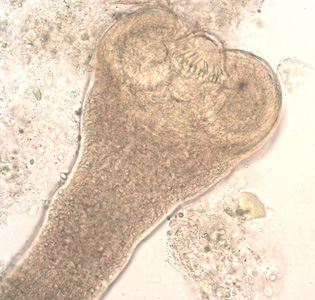 hymenolepidosis gyermekben