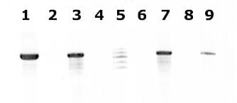 Agarose gel for E. histolytica PCR