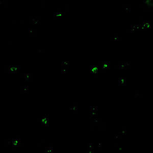 Positive IFA result with B. microti antigen.