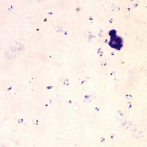 April - 2005 - Case #153