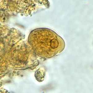 June - 2005 - Case #158