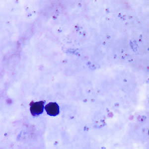 July - 2005 - Case #160