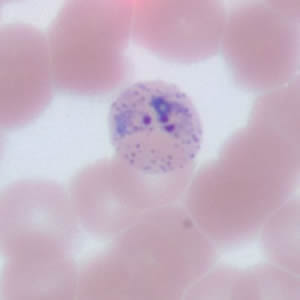 Recently DPDx telediagnosis inquiries received a request for assistance from the Medical College of Wisconsin. Images from a thin blood smear were submitted along with the patient's history of traveling to Honduras. 