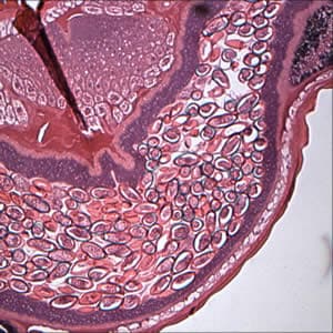 An elderly patient underwent a colonoscopy for polyps. A worm was seen near the appendiceal orifice and a biopsy was taken, fixed in formalin, and sent to histology. 