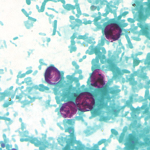 July - 2006 - Case #183