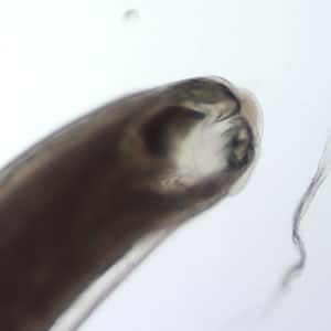 A worm measuring approximately 11 mm in length was sent to CDC for identification by a laboratory in the Southeastern United States. The following images were obtained by placing the worm on a 1" × 3" glass slide and gently "floating" a 24 × 30 mm glass coverslip on top of it with water. 