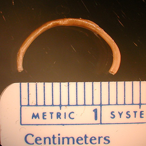 October - 2006 - Case #189