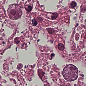 November - 2006 - Case #192