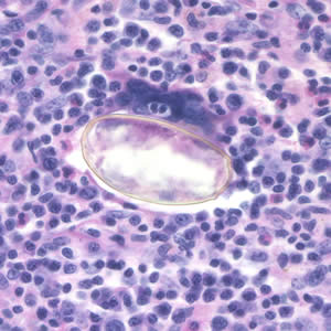 Case195_D.jpg Case195