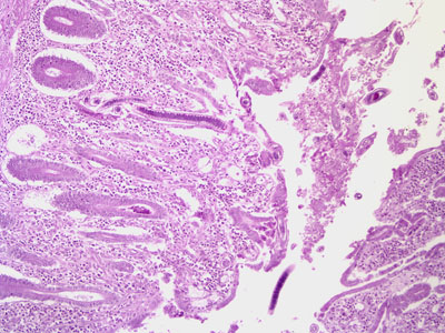 April - 2007 - Case #201