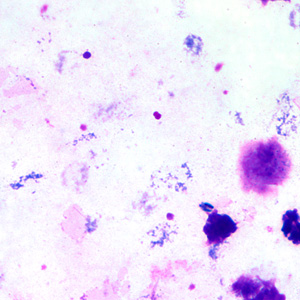 May - 2007 - Case #203