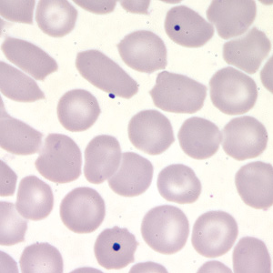 Case203_D.jpg Case203