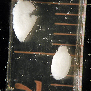 May - 2007 - Case #204