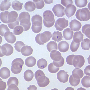 Case209_C.jpg Case209