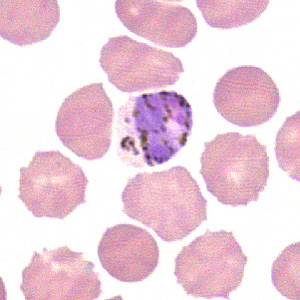 September - 2007 - Case #211