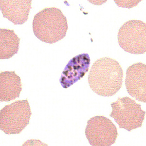 Case211_B.jpg Case211