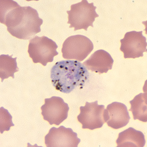 Case211_G.jpg Case211